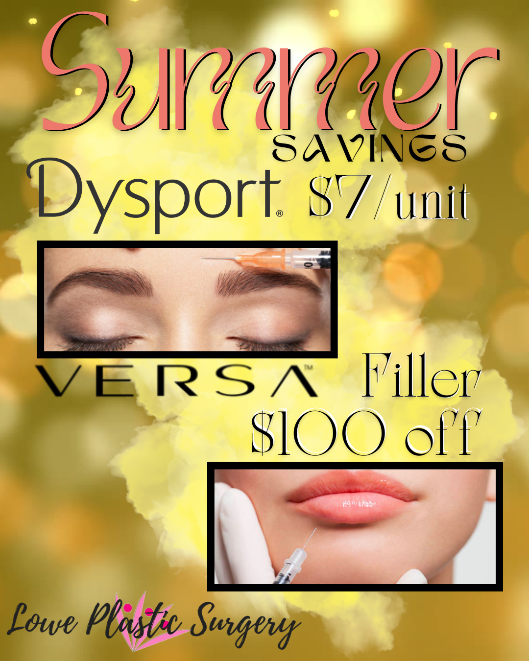 2025 summer Dysport filler photo