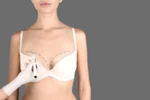 Plastic surgeon drawing pre-surgery markings on a woman's chest for breast lift or augmentation