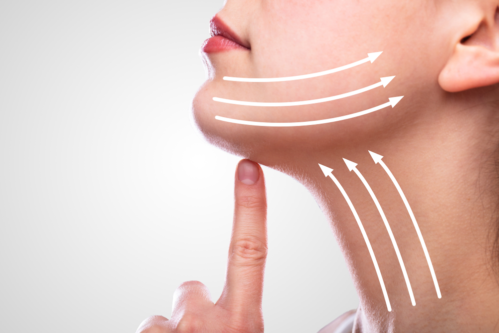 closeup of woman's neck with arrows pointing up to demonstrate a neck lift.