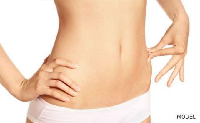 Abdominoplasty